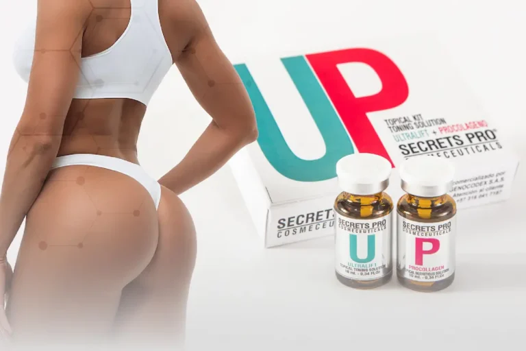 Up